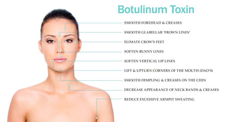 Botulinum Toxin  (2)