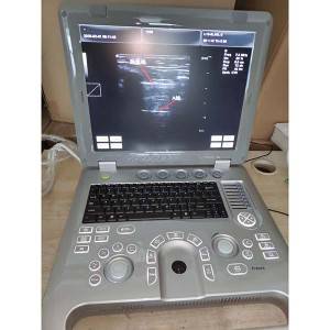 laptop ultrasound  for GYN, OB, Urology diagnostic