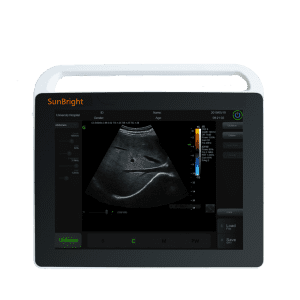 15  inches Touch Screen Laptop Ultrasound Sun-800S