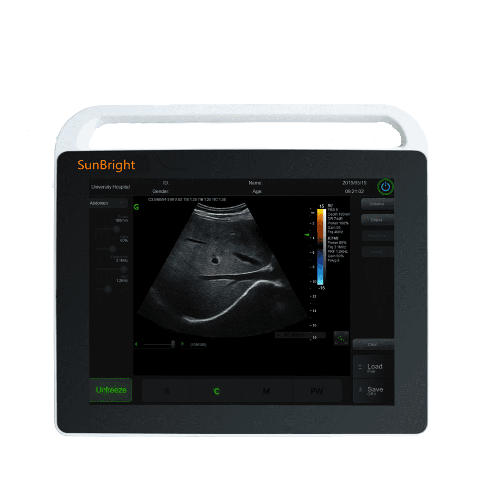 15  inches Touch Screen Laptop Ultrasound Sun-800S Featured Image