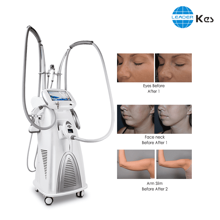 Body shape scuplting fast slimming system radio frequency facial velashape slimming machine