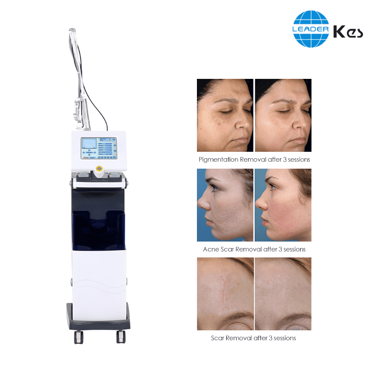 10600nm CO2 Fractional Laser for Beauty Salon Clinic Equipment Skin Tightening Vaginal Laser