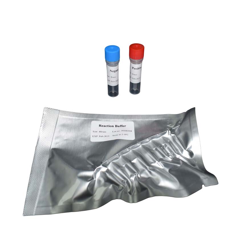 China SARS-CoV-2 Nucleic Acid Detection Kit manufacturers and suppliers | Jianma