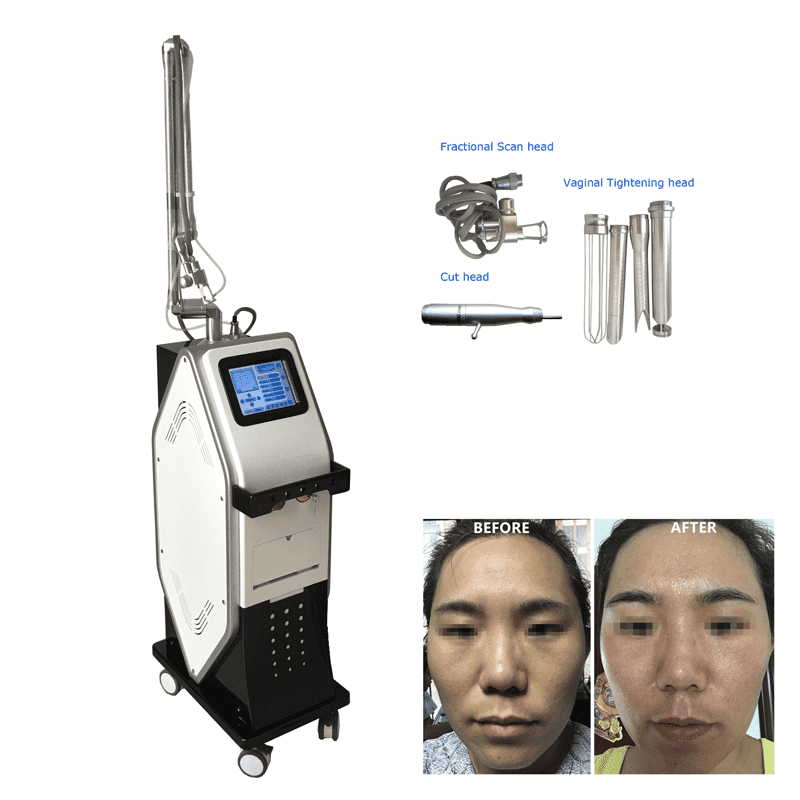 co2 fractional rf tube laser device for skin resurfacing