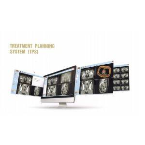 Treatment Planning System