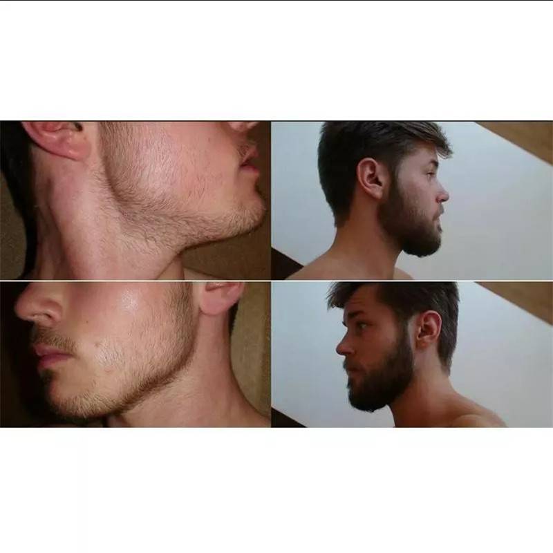 Beard-Growth-Spray (3)
